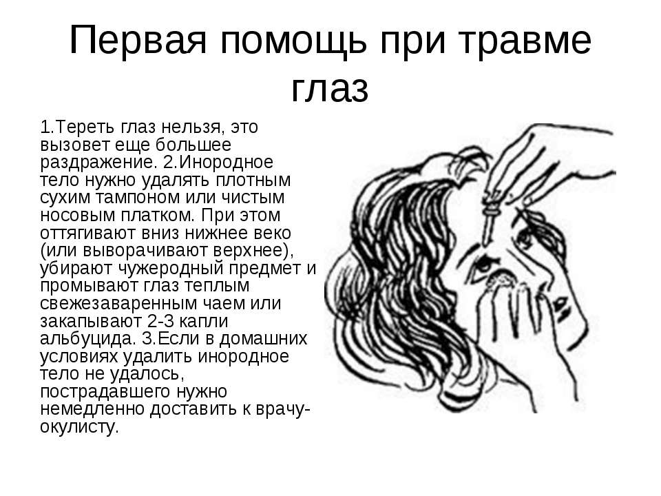 Трэмы glaз | 
